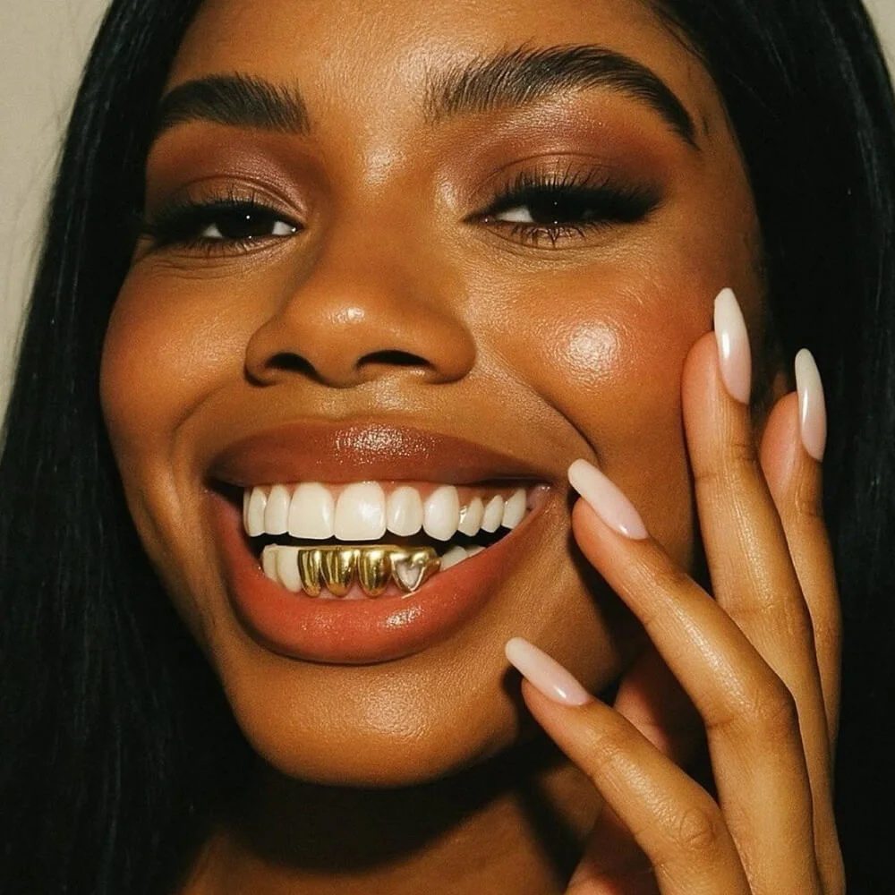 Custom gold grillz crafted by Beam Confident