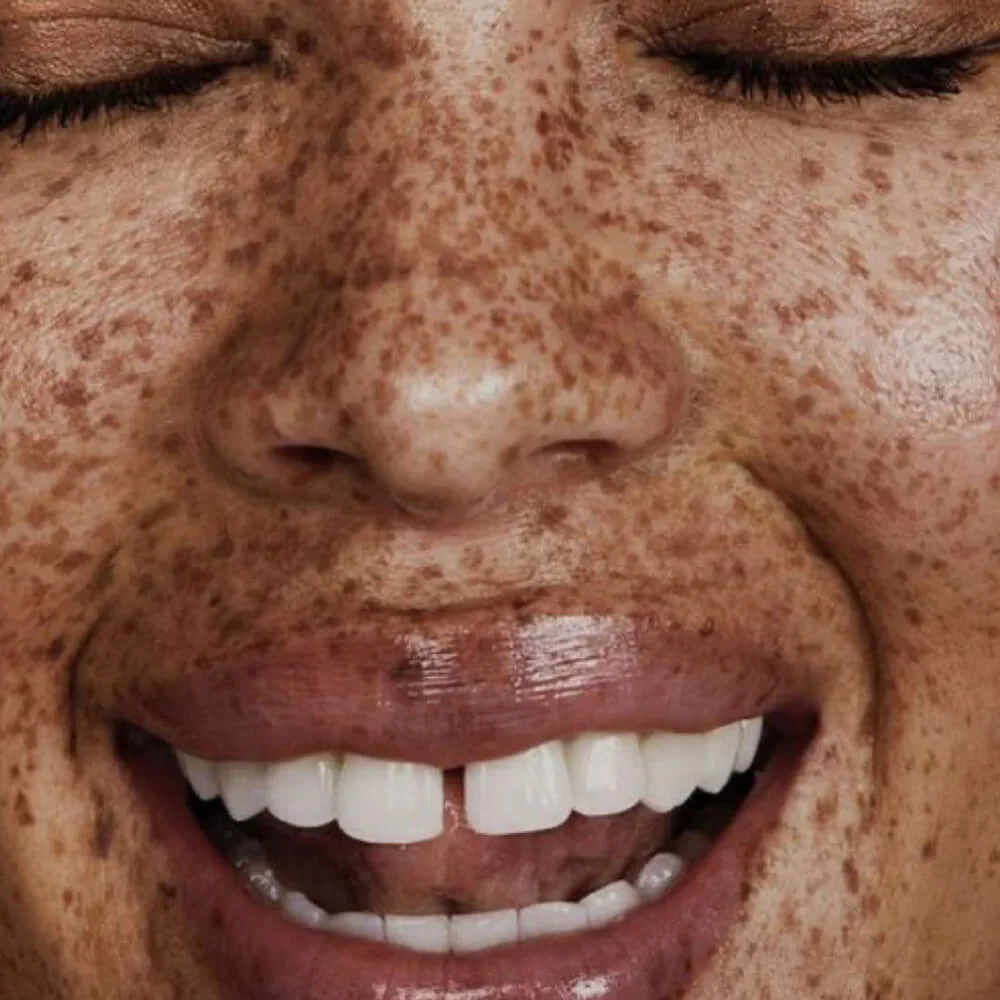 Close-up of smiling mouth showing bright white teeth